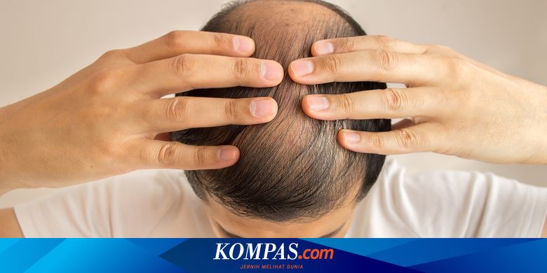 Mengatasi Kebotakan dengan Menumbuhkan Rambut, Mungkinkah? Halaman all -  Kompas.com